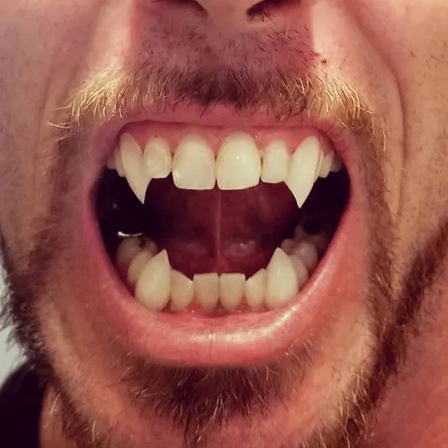 Custom Fangs Services