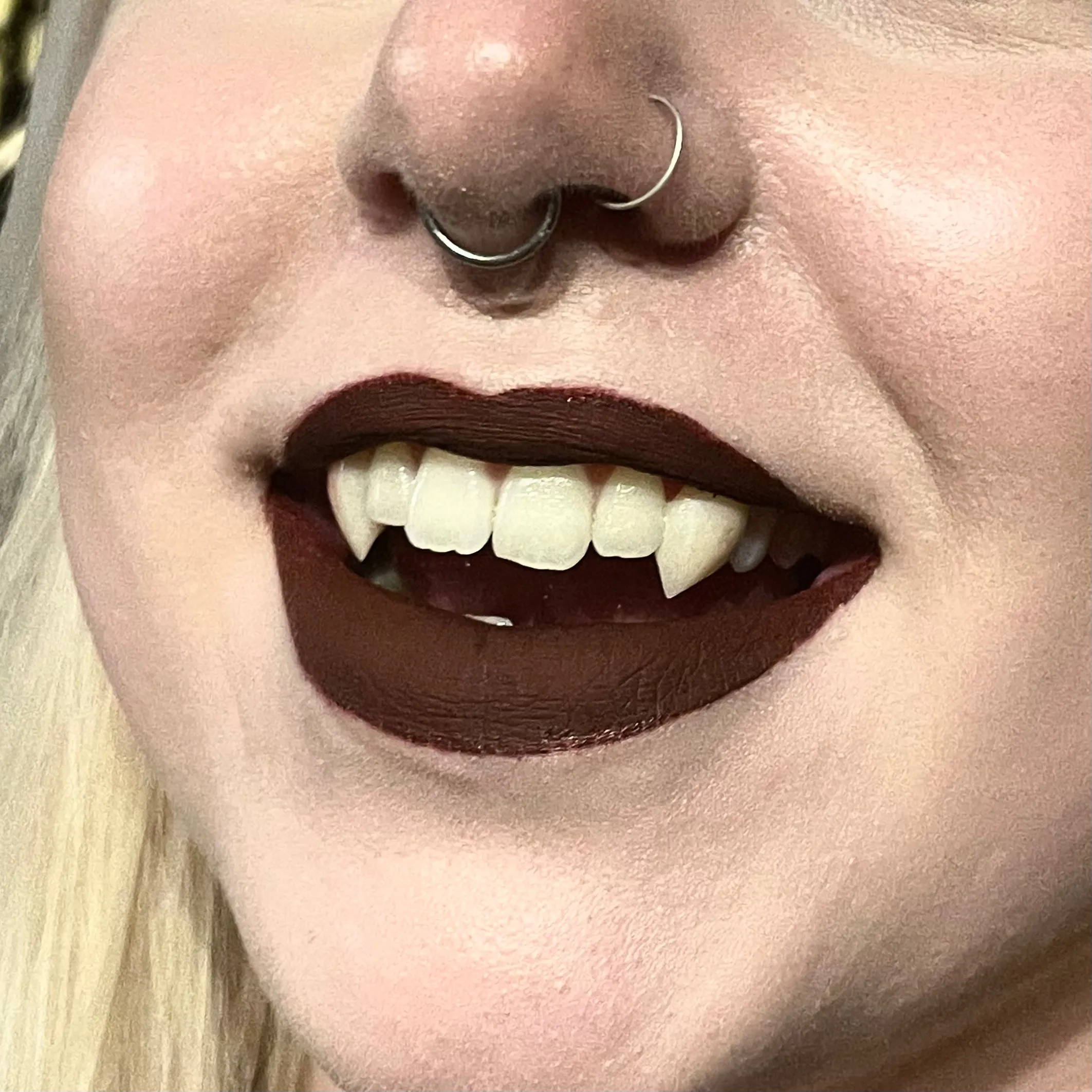 Custom Fangs Services